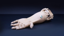 prosthetic arm